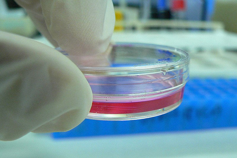 800px-Cell_Culture_in_a_tiny_Petri_dish