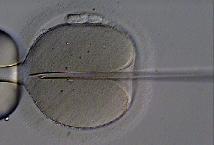 Fecondation in vitro