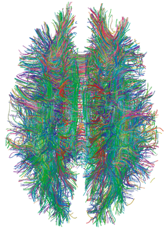 White_Matter_Connections_Obtained_with_MRI_Tractography